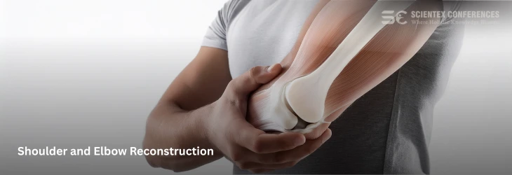 Shoulder and Elbow Reconstruction